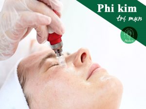 phi kim trị mụn là gì