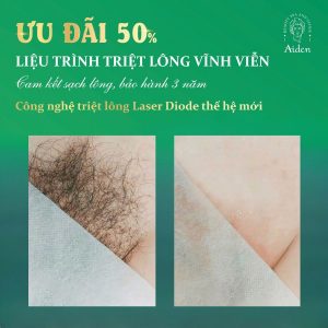 Triệt lông bikini Triệt lông bikini