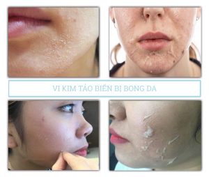 chăm sóc da sau vi kim tảo biển
