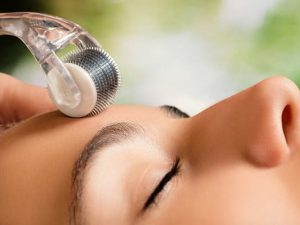 1 liệu trình lăn kim bao nhiêu tiền