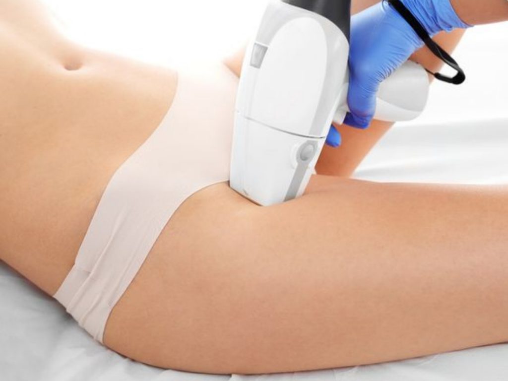 sau khi triệt lông bikini có được quan hệ không