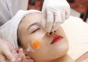 sau lăn kim bao lâu thì được đắp mặt nạ