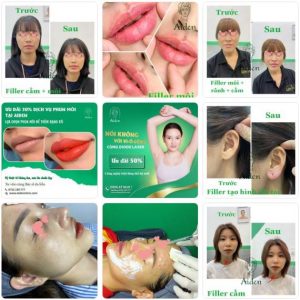 thẩm mỹ viện uy tín nhất tphcm