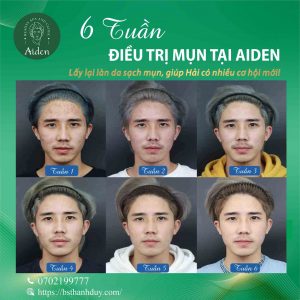 thẩm mỹ viện uy tín ở sài gòn