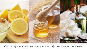 Cách trị quầng thâm mắt bằng dầu dừa - 1