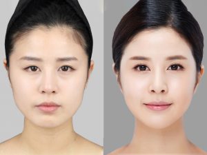 Khung khuôn mặt tỉ lệ vàng nữ Khung khuôn mặt tỉ lệ vàng nữ