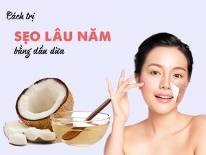 Cách trị sẹo bỏng thâm lâu năm bằng dầu dừa Cách trị sẹo bỏng thâm lâu năm bằng dầu dừa