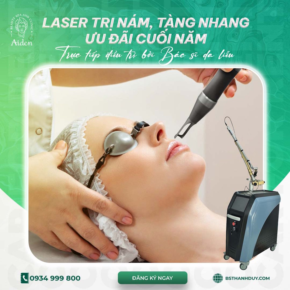 Điều trị nám bằng Q-switched Nd YAG