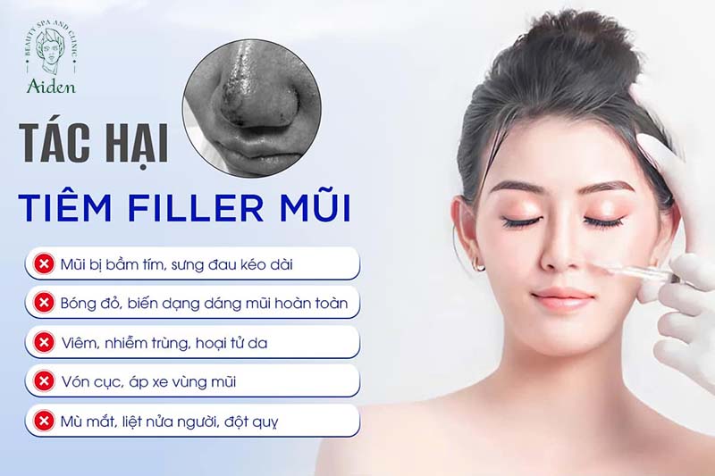 Tac-hai-cua-tiem-filler-mui