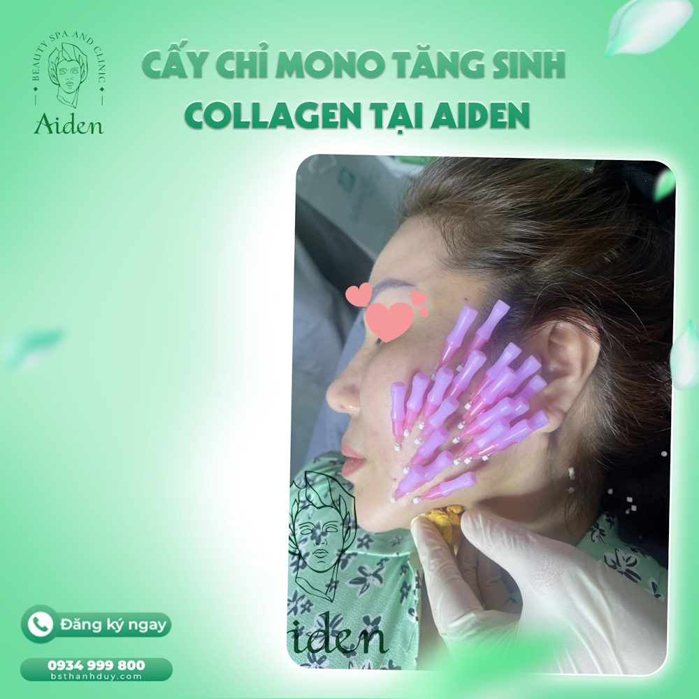 cay-chi-mono-tang-sinh-collagen