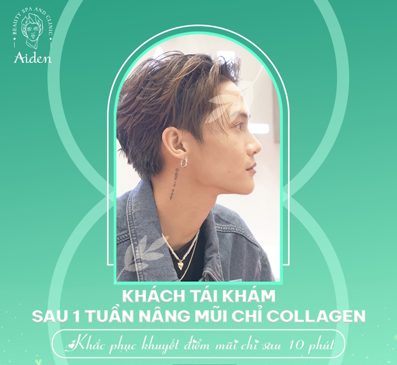 nang-mui-chi-tai-aiden-beauty-spa-clinic