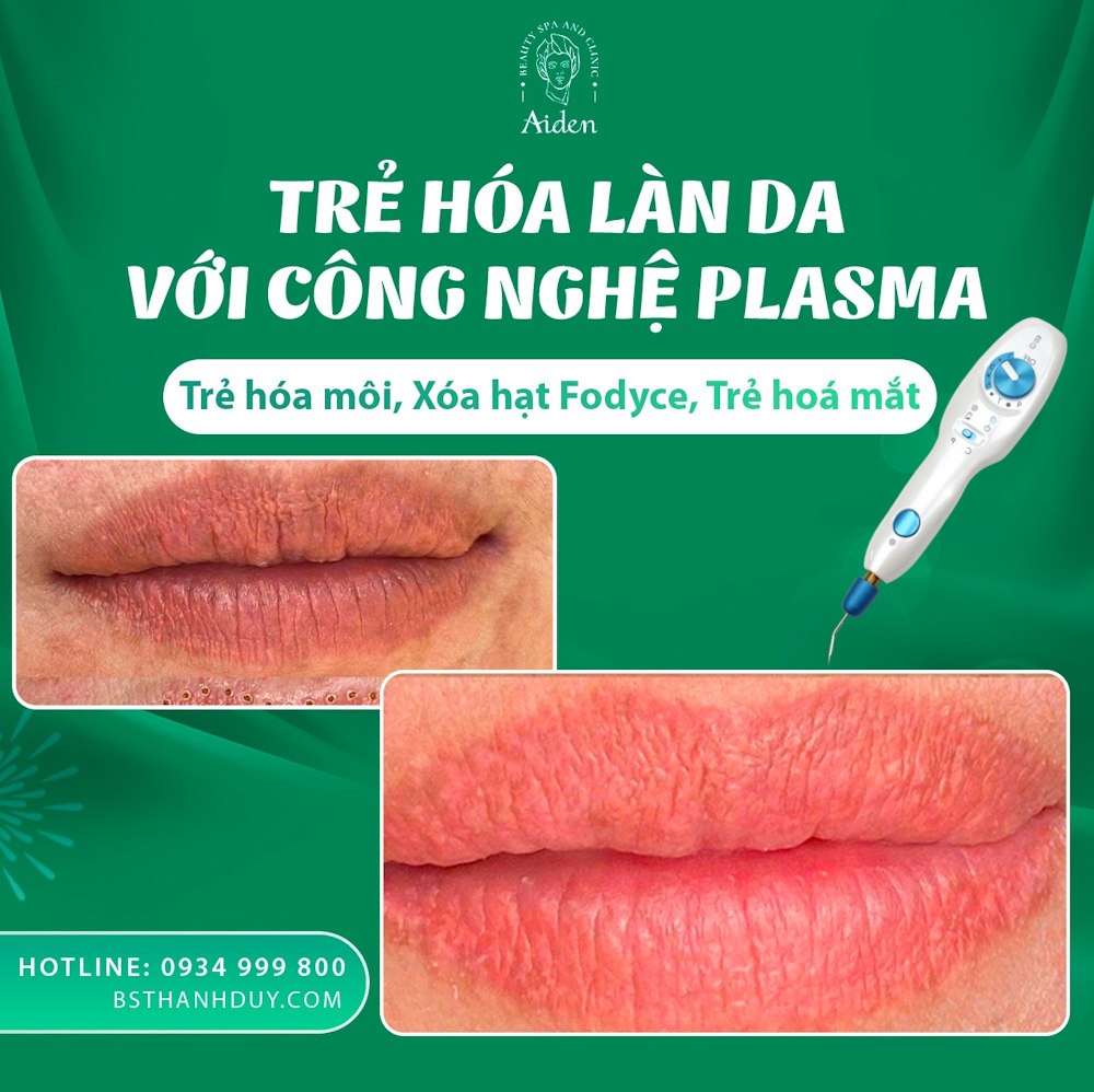 Plasmatrẻ hóa môi