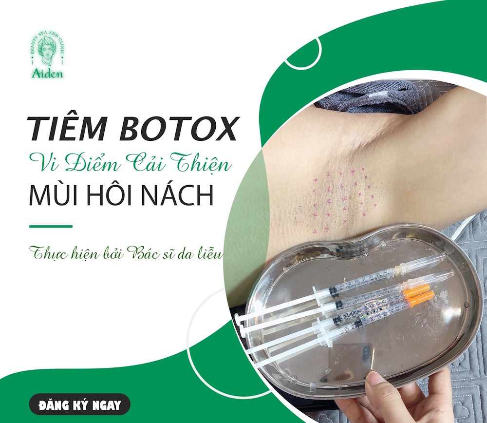 lieu-trinh-tiem-botox-giam-mui-hoi-duoi-canh-tay