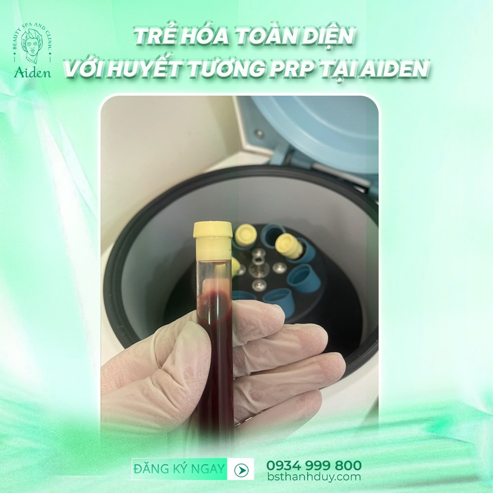 tiem-prp-tre-hoa-da-an-toan