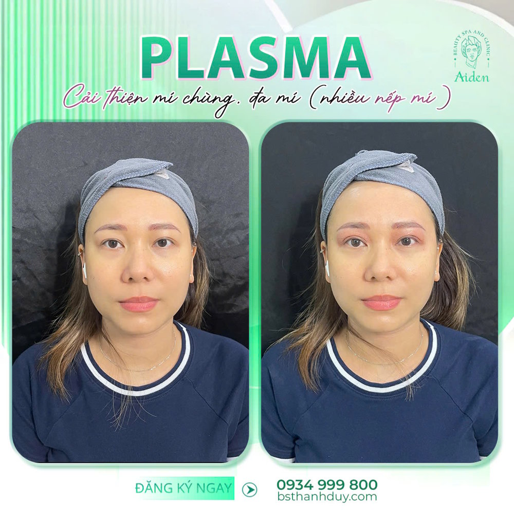 Công nghệ plasma tái tạo da