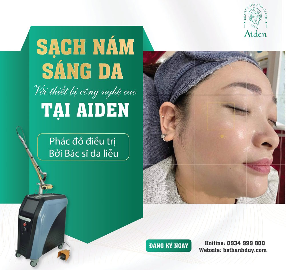 Điều trị nám bằng laser pico