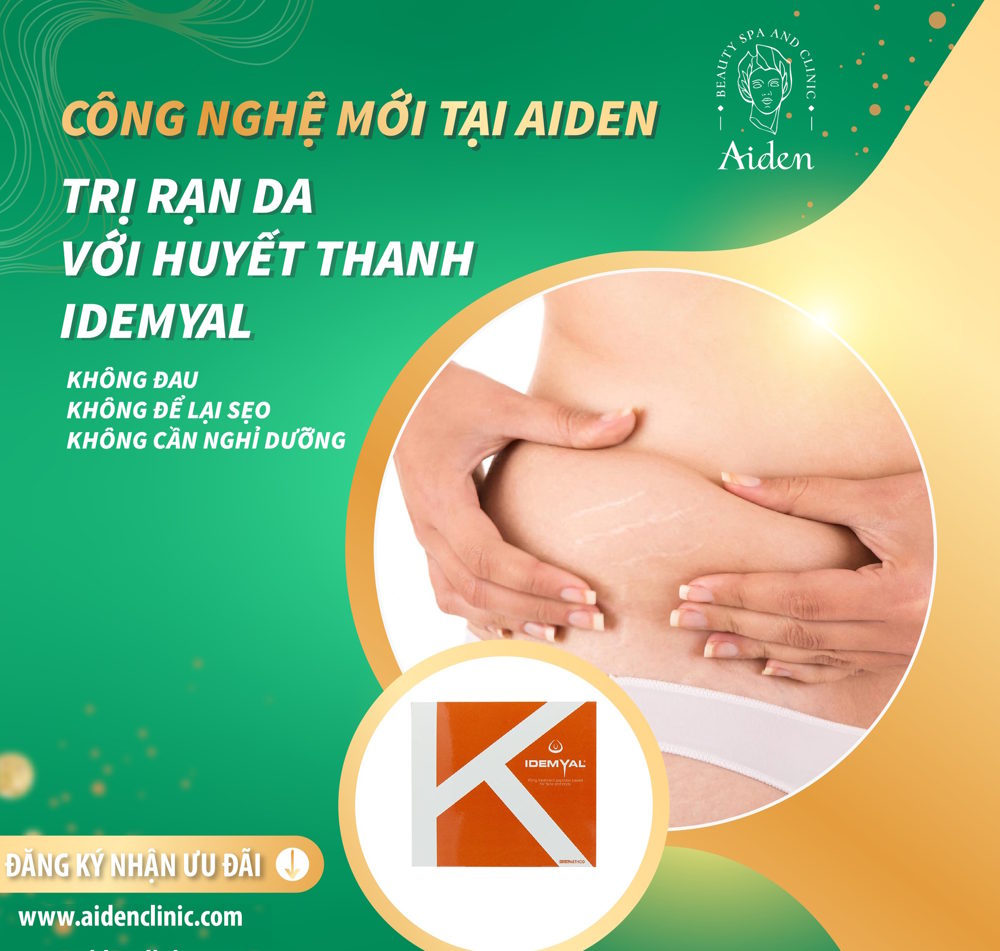 Rạn da lâu năm có điều trị được không