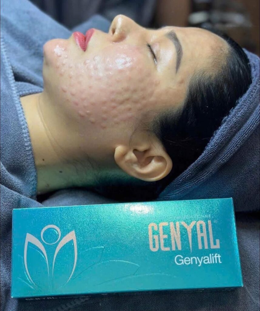 Công dụng của tiêm meso