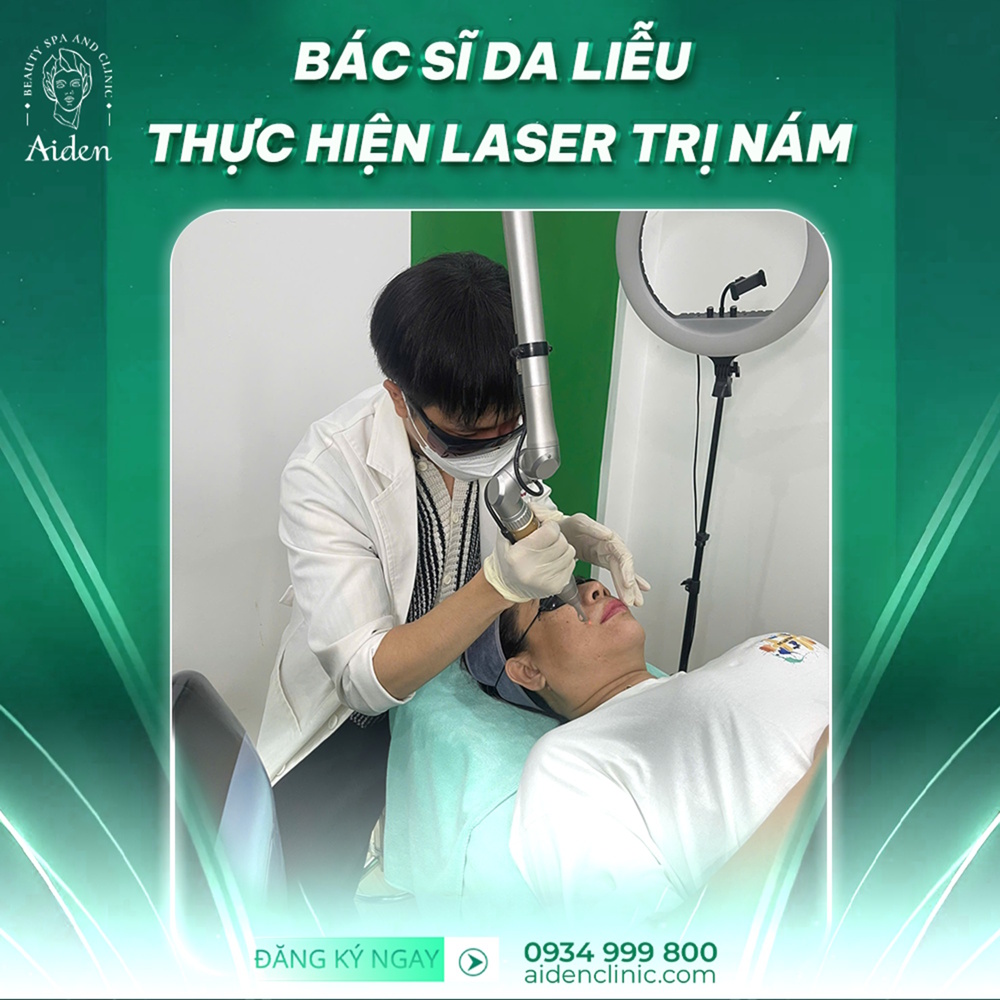 Điều trị nám bằng laser pico