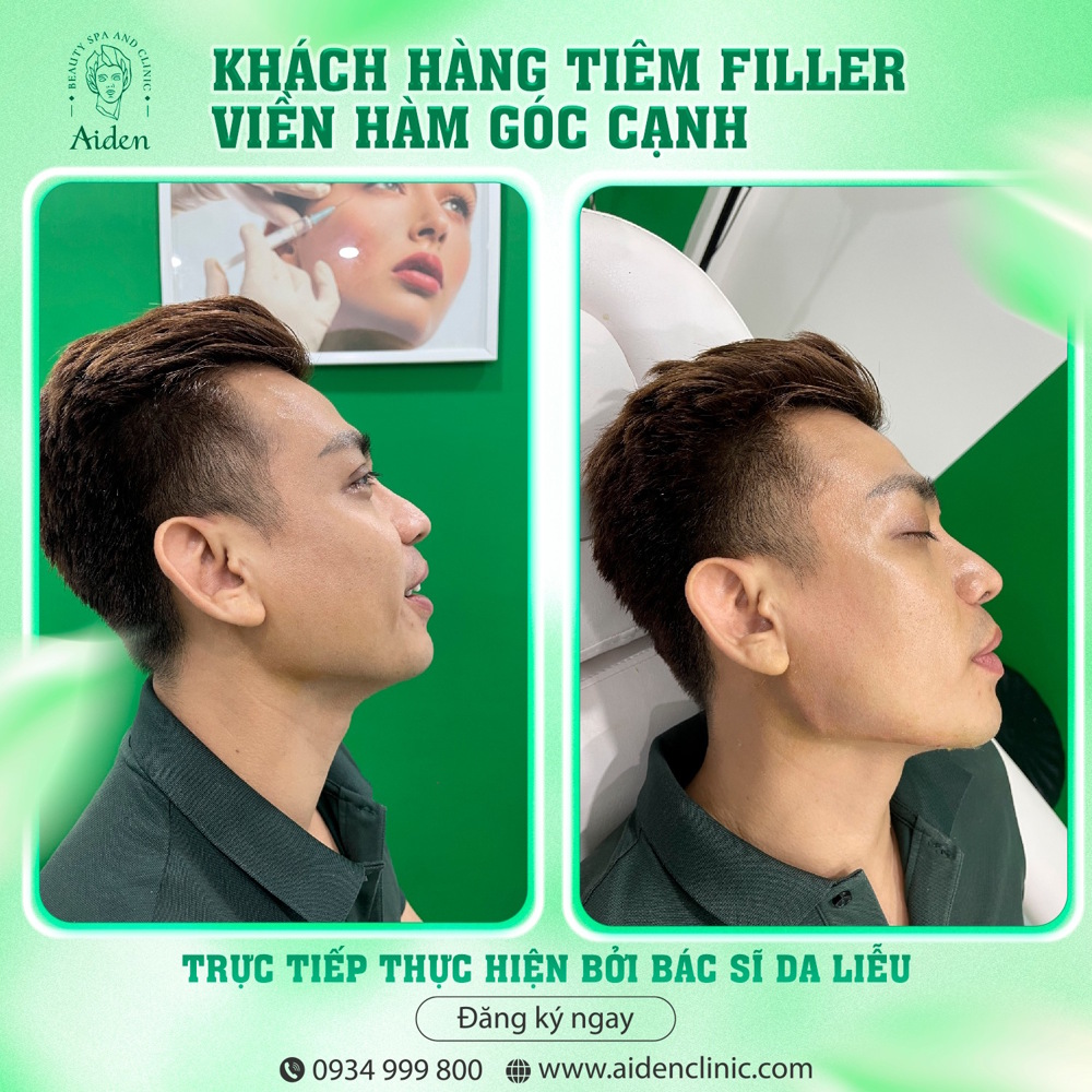 tao-duong-vien-ham-jawline