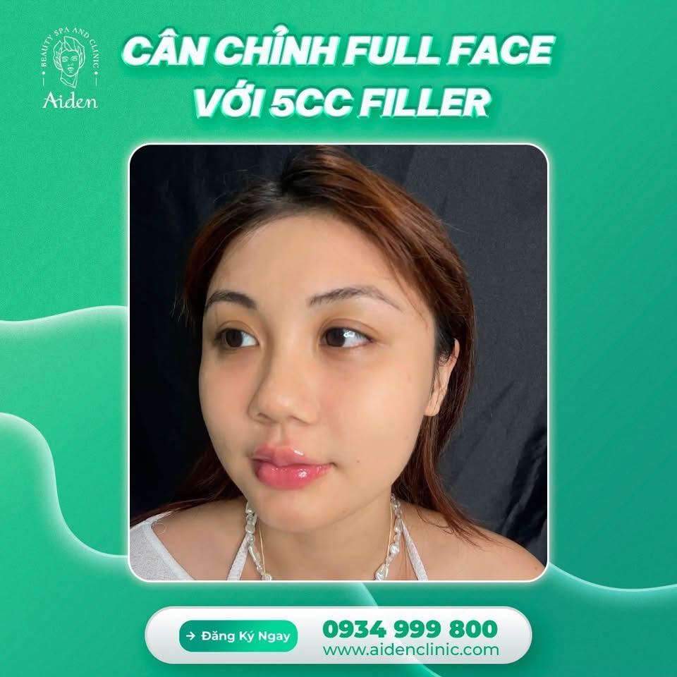 nan-can-chinh-sau-khi-tiem-filler-full-face