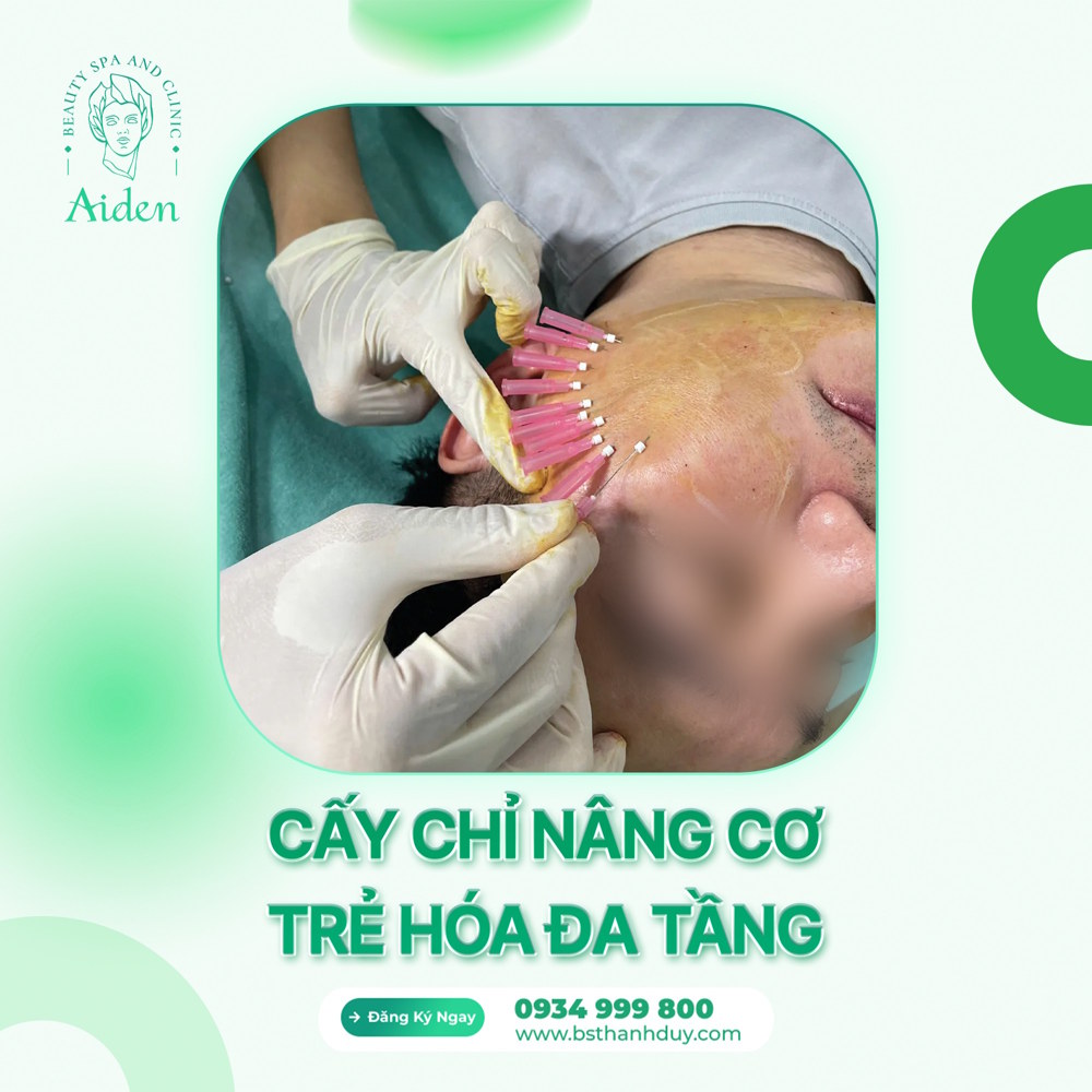 Căng chỉ collagen trẻ hóa