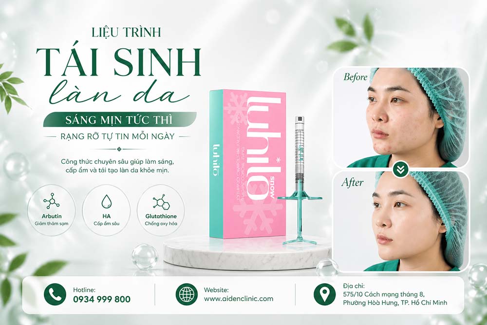 Rạn da lâu năm có điều trị được không