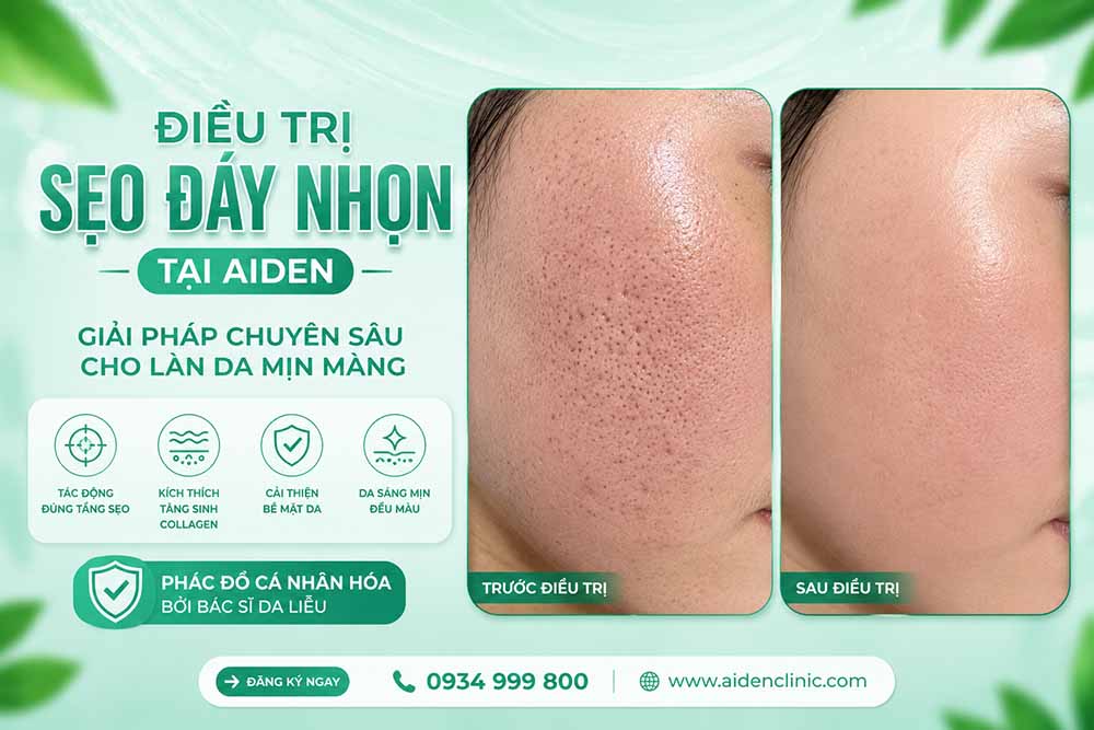 Tuyển mẫu điều trị sẹo