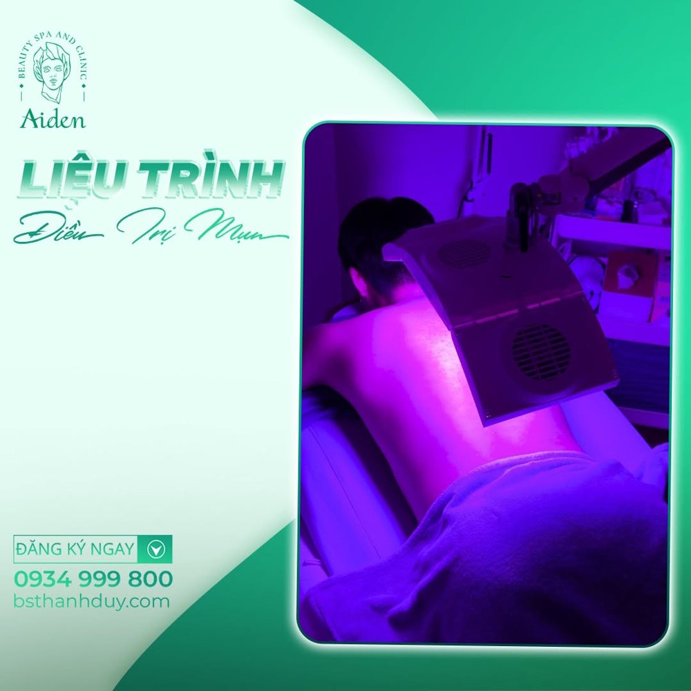 điều trị mụn viêm