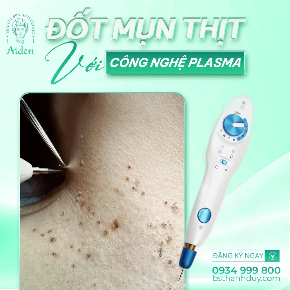 Plasma là gì