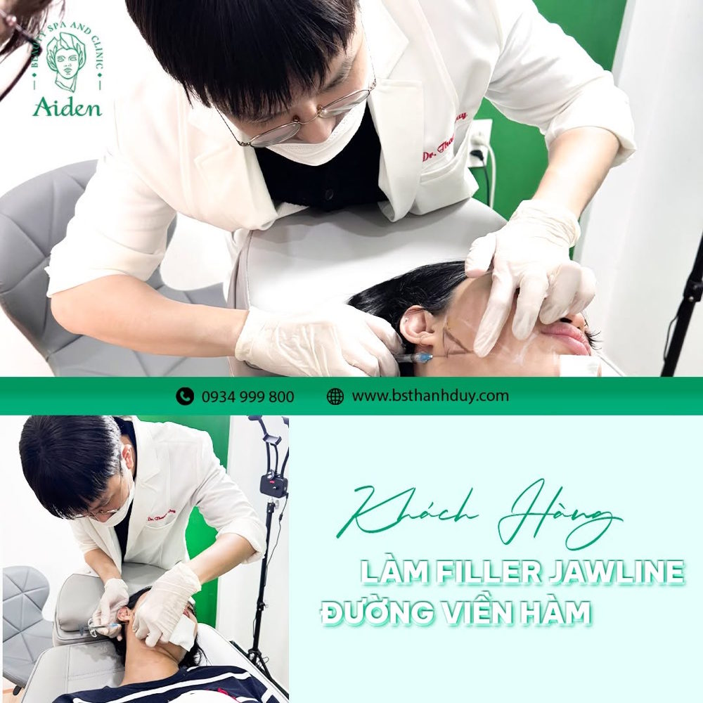 Filler injection cost